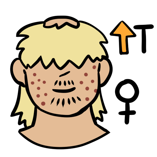 a person with light skin tone. They have acne, facial hair, and a bald spot on the top of their head. They have blonde hair. In the upper left of the image is an orange up arrow next to the letter T. In the bottom left is a female symbol.